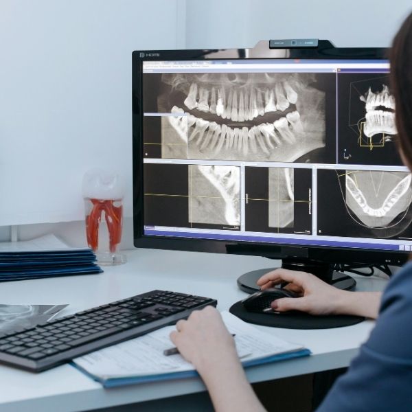 Digital dental X-rays