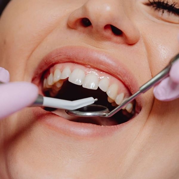 Full mouth rehabilitation