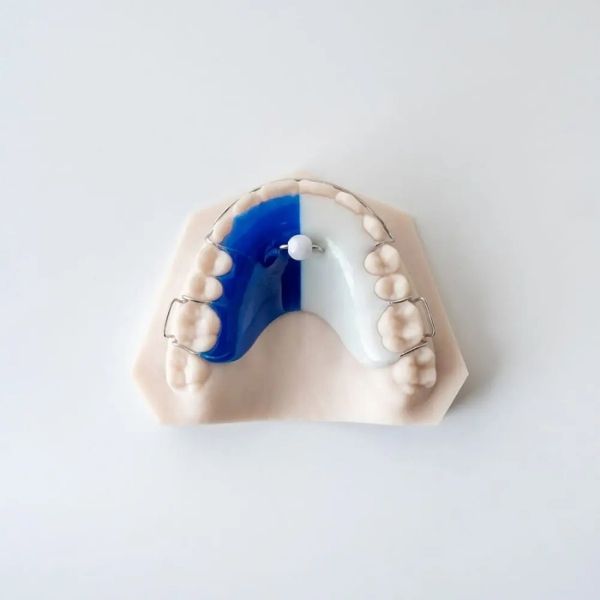 Custom habit appliances for children